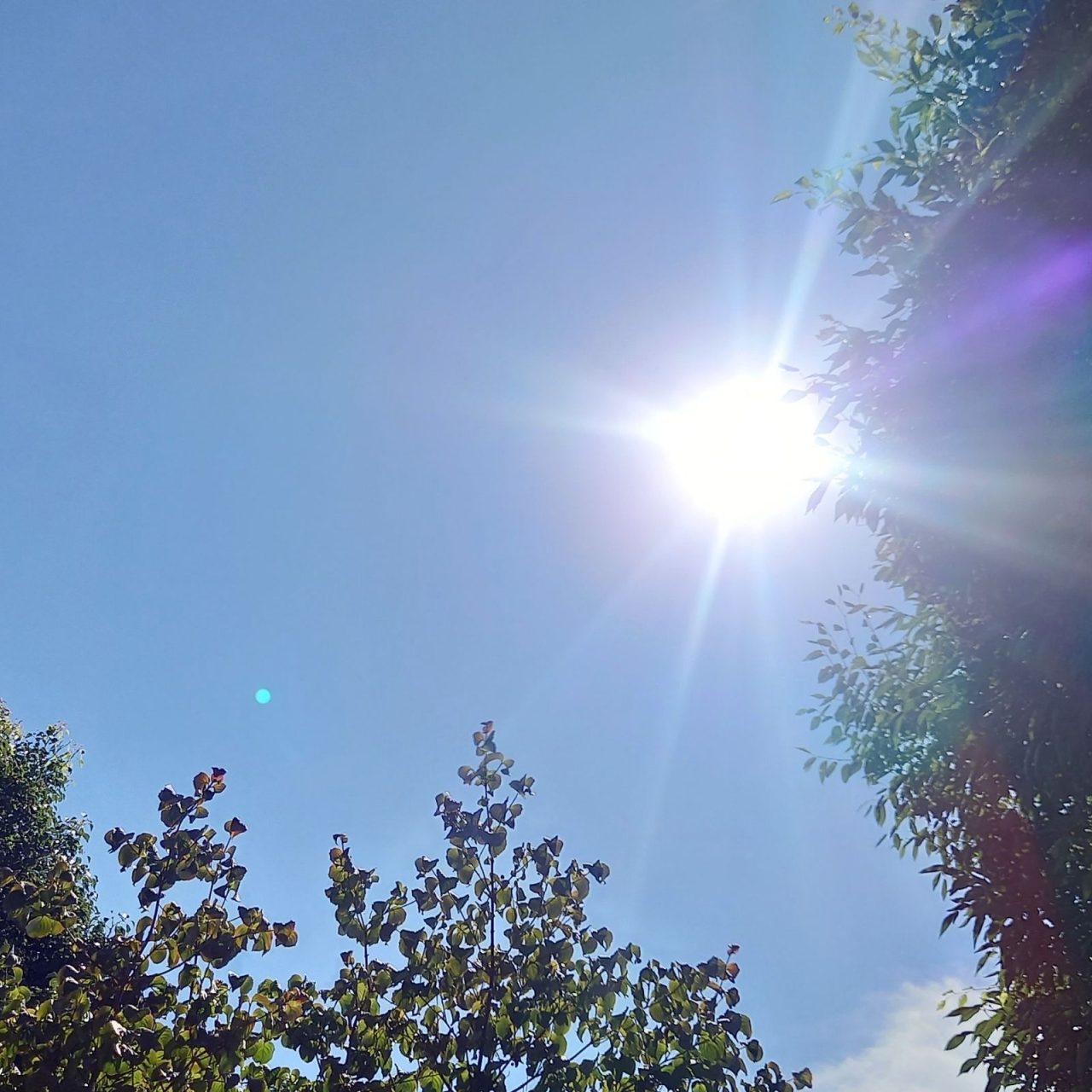 夏の青空と、木々のあいだから差し込む強い日差し